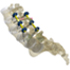 Spinal Fixation Systems
